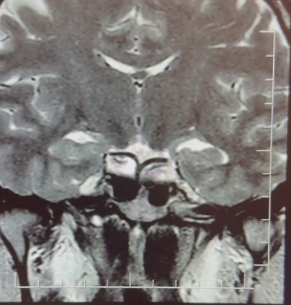 hamileyim diye geldi tumor teshisi konuldu 2 kjWJYrCy