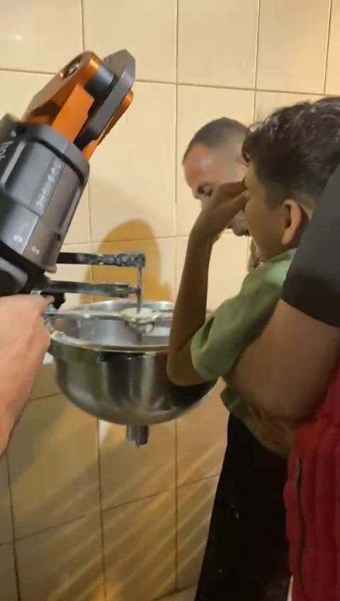 hamur karistirma makinesine elini sikistiran cocugu itfaiye kurtardi 3 NiFwBndv