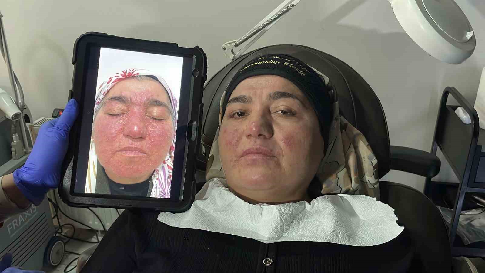 hastaligi yuzunden yillarca evden cikamadi simdi ise cekinmeden cikabiliyor 0 ugHLIY7M