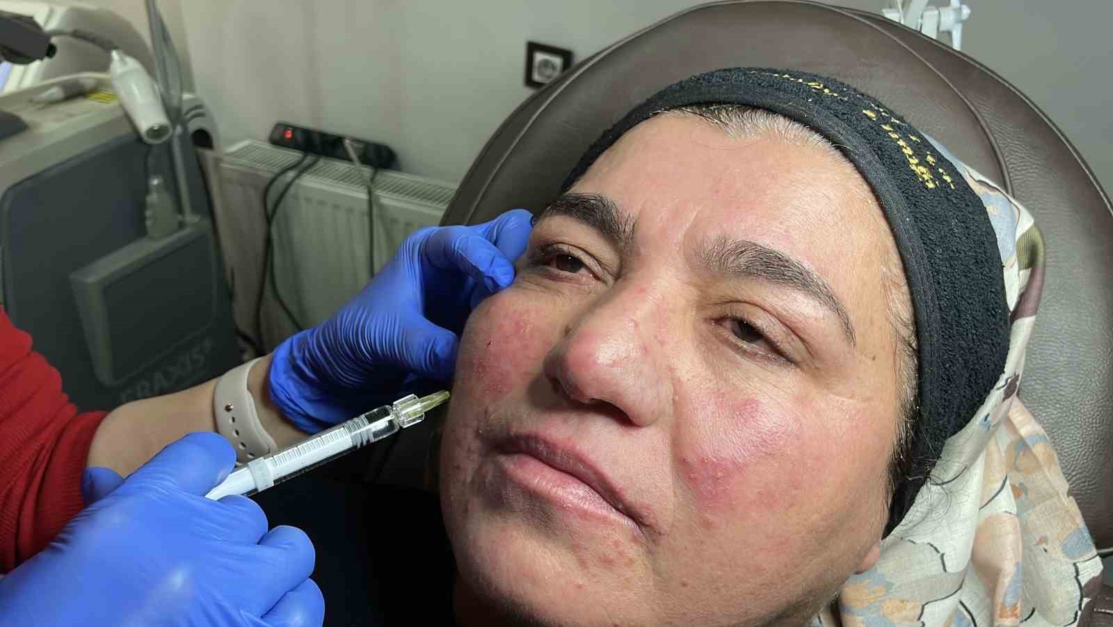 hastaligi yuzunden yillarca evden cikamadi simdi ise cekinmeden cikabiliyor 4 lidqQeXC