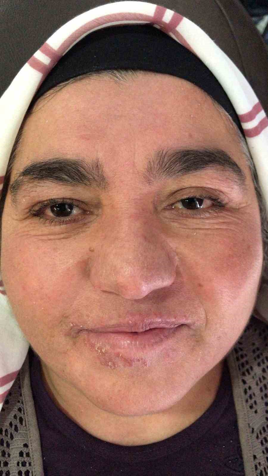 hastaligi yuzunden yillarca evden cikamadi simdi ise cekinmeden cikabiliyor 7