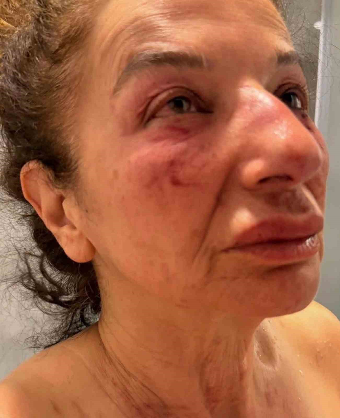 Hayvanlara yardım bahanesiyle ayağına çağırıp dehşeti yaşattı 5 hayvanlara yardim bahanesiyle ayagina cagirip dehseti yasatti 1 CXTjyAlb