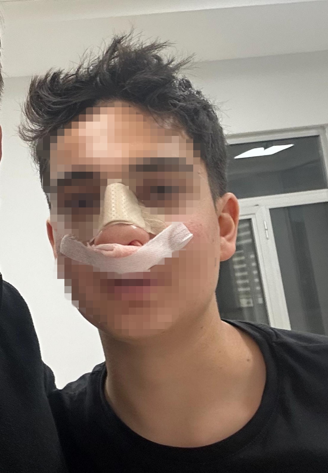 hic tanimadiklari genci neden bakiyorsun diye darp edip burnunu kirdilar 6 zSklfNIH