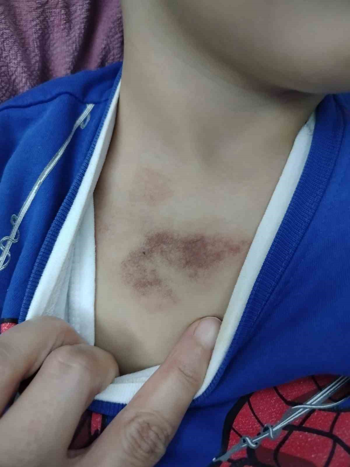 ibb kresinde istismar ve darp iddiasi cocuklari tacize ugrayan aile sikayetci oldu 2 aU4mD1Xg