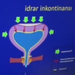 idrar-kacirma-uyarisi-doguma-ve-yaslanmaya-bagliyor-utanip-basvuramiyorlar-ek4jTKLs.jpg