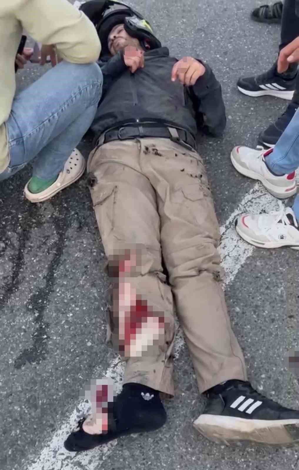 Iğdır-Doğubeyazıt yolunda motosiklet bariyerlere çarptı: 2 yaralı 4 igdir dogubeyazit yolunda motosiklet bariyerlere carpti 2 yarali 0 chcVCqmR