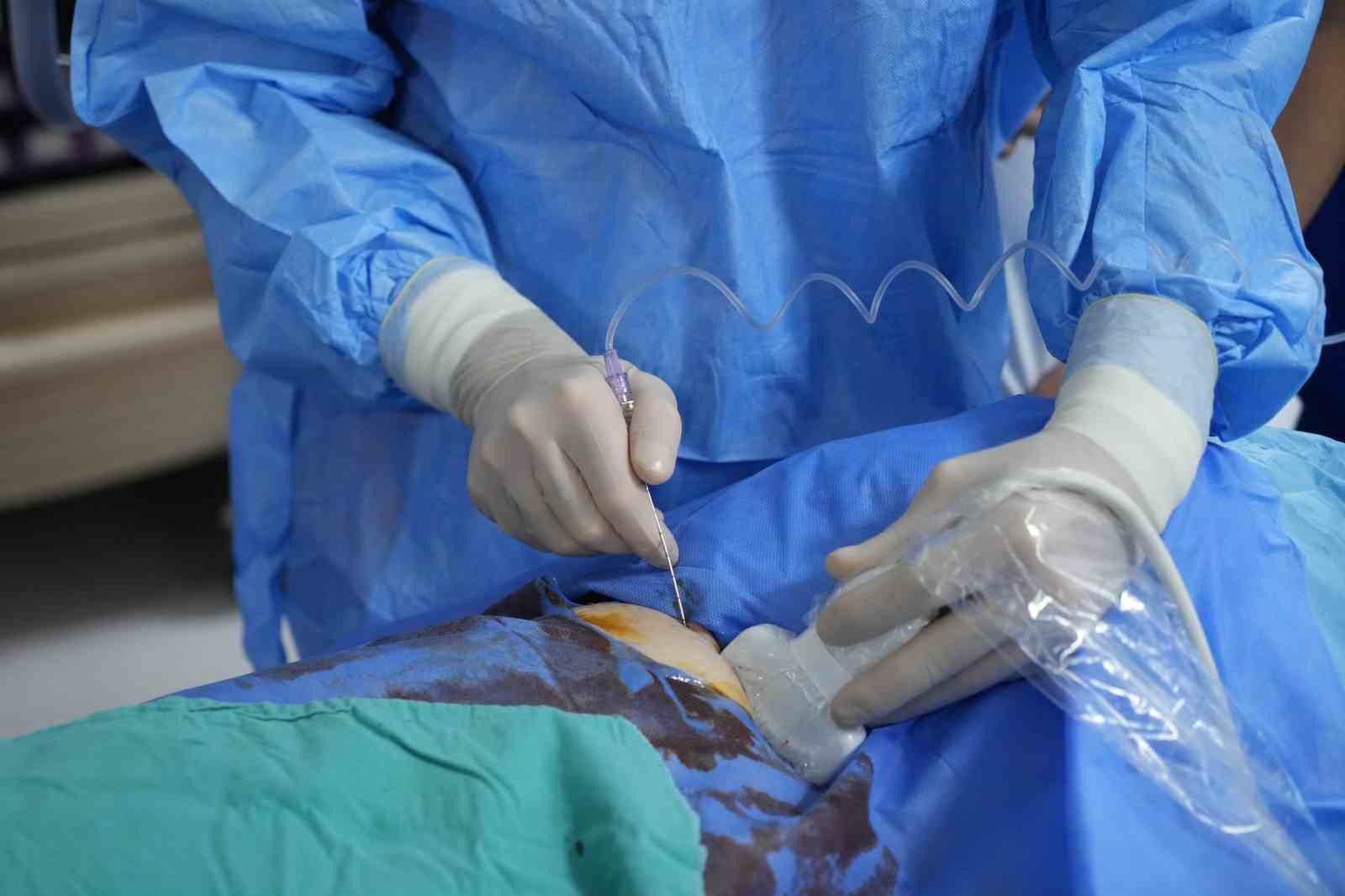 igneyle tumor tedavisine uluslararasi ilgi canli canli izlediler 1 OUsRQd2f