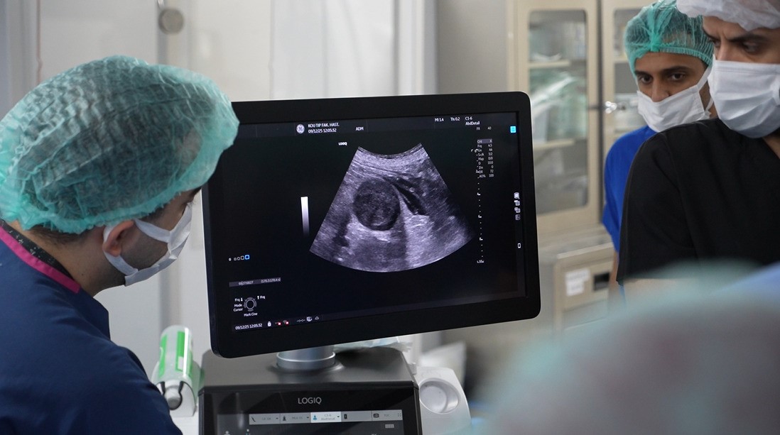 igneyle tumor tedavisine uluslararasi ilgi canli canli izlediler 4 yF1kLBWy