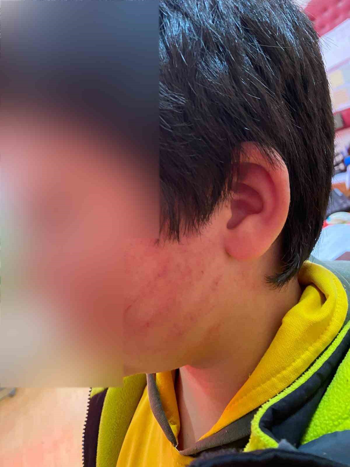 İlkokul öğrencilerinin sıra tartışmasında okula gelen baba, anne ve babaanne 2 çocuğu darp etti 8 ilkokul ogrencilerinin sira tartismasinda okula gelen baba anne ve babaanne 2 cocugu darp etti k2H2mV8y