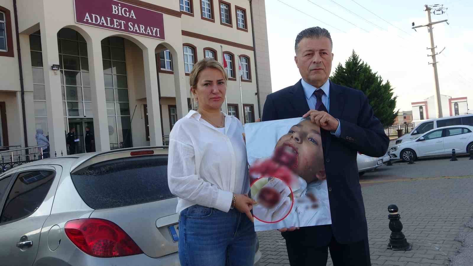 ilkokul ogrencisinin cenesi saplanan demir yuzunden koptu ailesi okula ihmal davasi acti 0