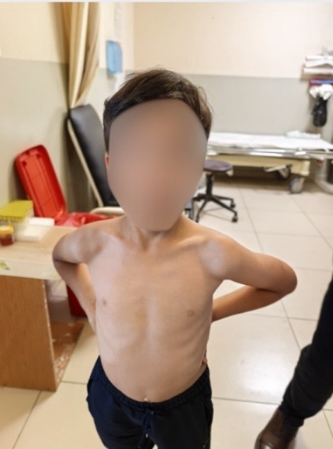 inegolde kene alarmi 2 MvqpNaRO