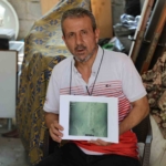 is-kazasi-gecirdi-ameliyat-oldu-belinde-panc-unutuldu-uYp2ZMpF.jpg