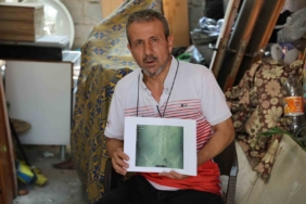 is-kazasi-gecirdi-ameliyat-oldu-belinde-panc-unutuldu-uYp2ZMpF.jpg