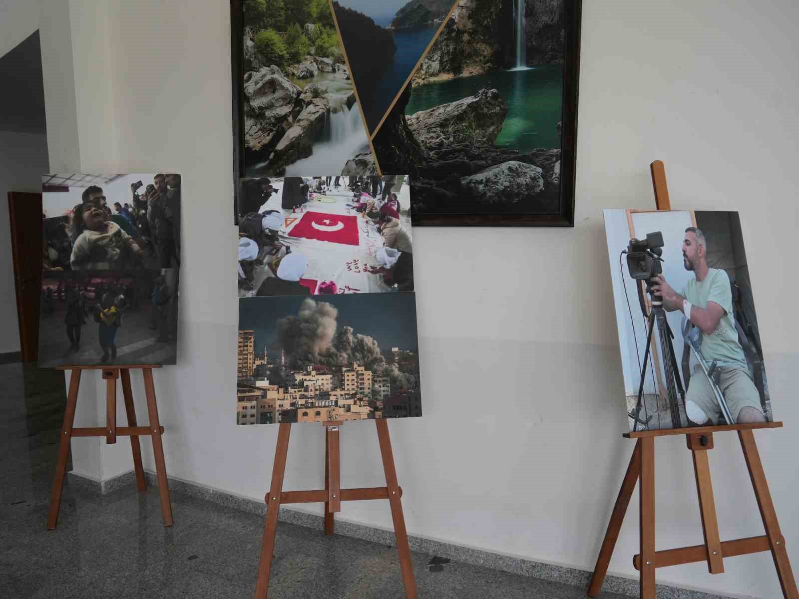 İsrail saldırısında bir bacağını kaybeden Filistinli gazeteci, Gazze’deki zulmü anlattı 18 israil saldirisinda bir bacagini kaybeden filistinli gazeteci gazzedeki zulmu anlatti 14 LX4e8WAk