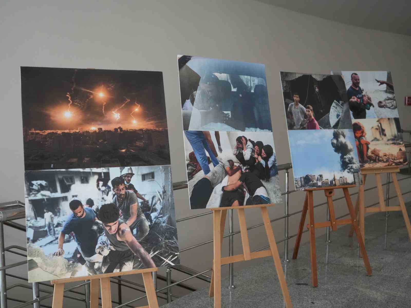 İsrail saldırısında bir bacağını kaybeden Filistinli gazeteci, Gazze’deki zulmü anlattı 19 israil saldirisinda bir bacagini kaybeden filistinli gazeteci gazzedeki zulmu anlatti 15 dhO1Bv9w