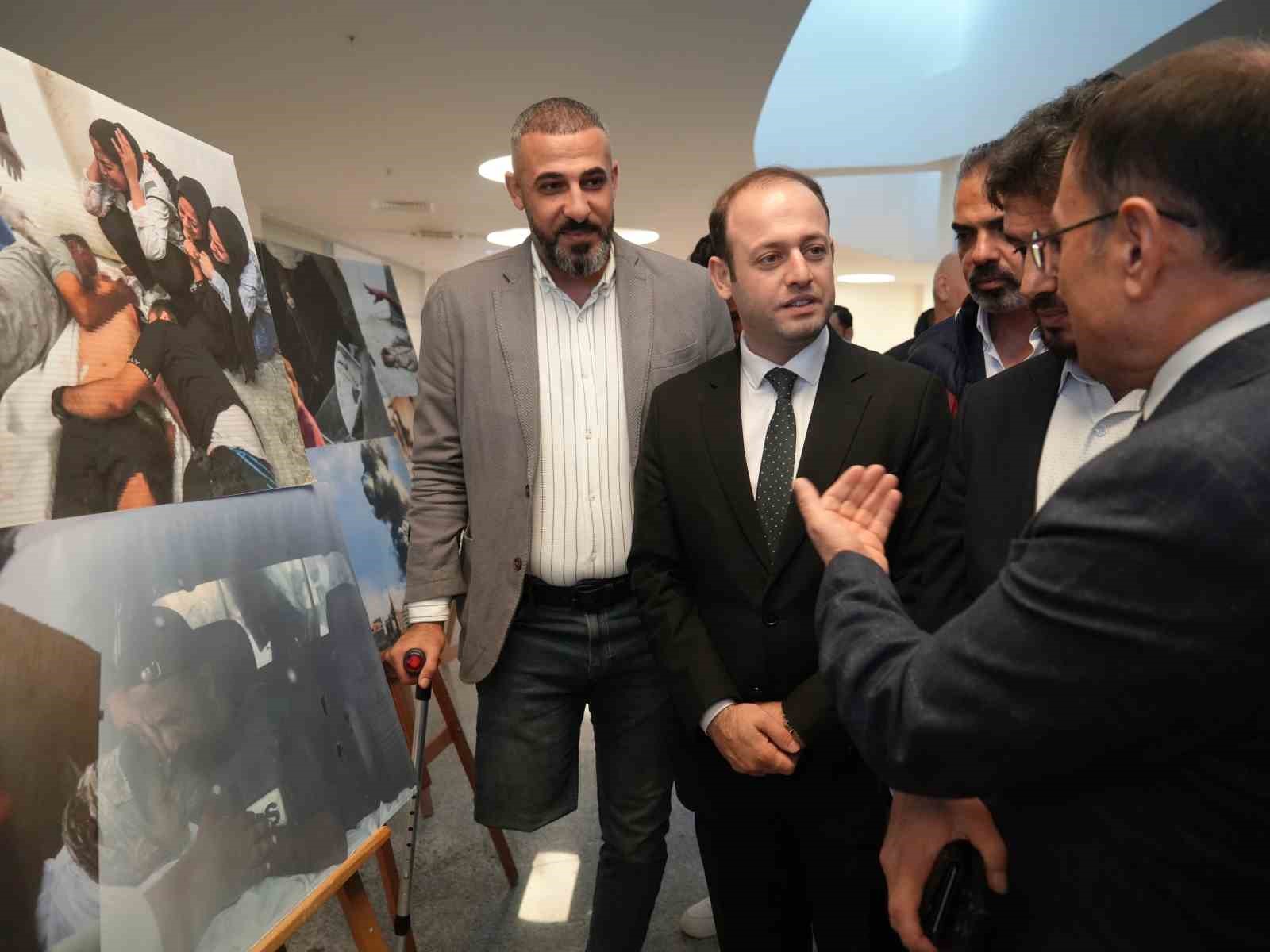 İsrail saldırısında bir bacağını kaybeden Filistinli gazeteci, Gazze’deki zulmü anlattı 11 israil saldirisinda bir bacagini kaybeden filistinli gazeteci gazzedeki zulmu anlatti 7 O7Fa1FLd