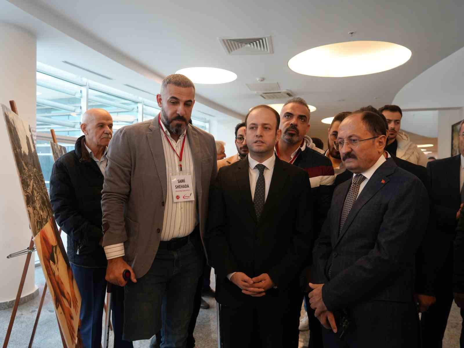 İsrail saldırısında bir bacağını kaybeden Filistinli gazeteci, Gazze’deki zulmü anlattı 12 israil saldirisinda bir bacagini kaybeden filistinli gazeteci gazzedeki zulmu anlatti 8 tMSPwdYY