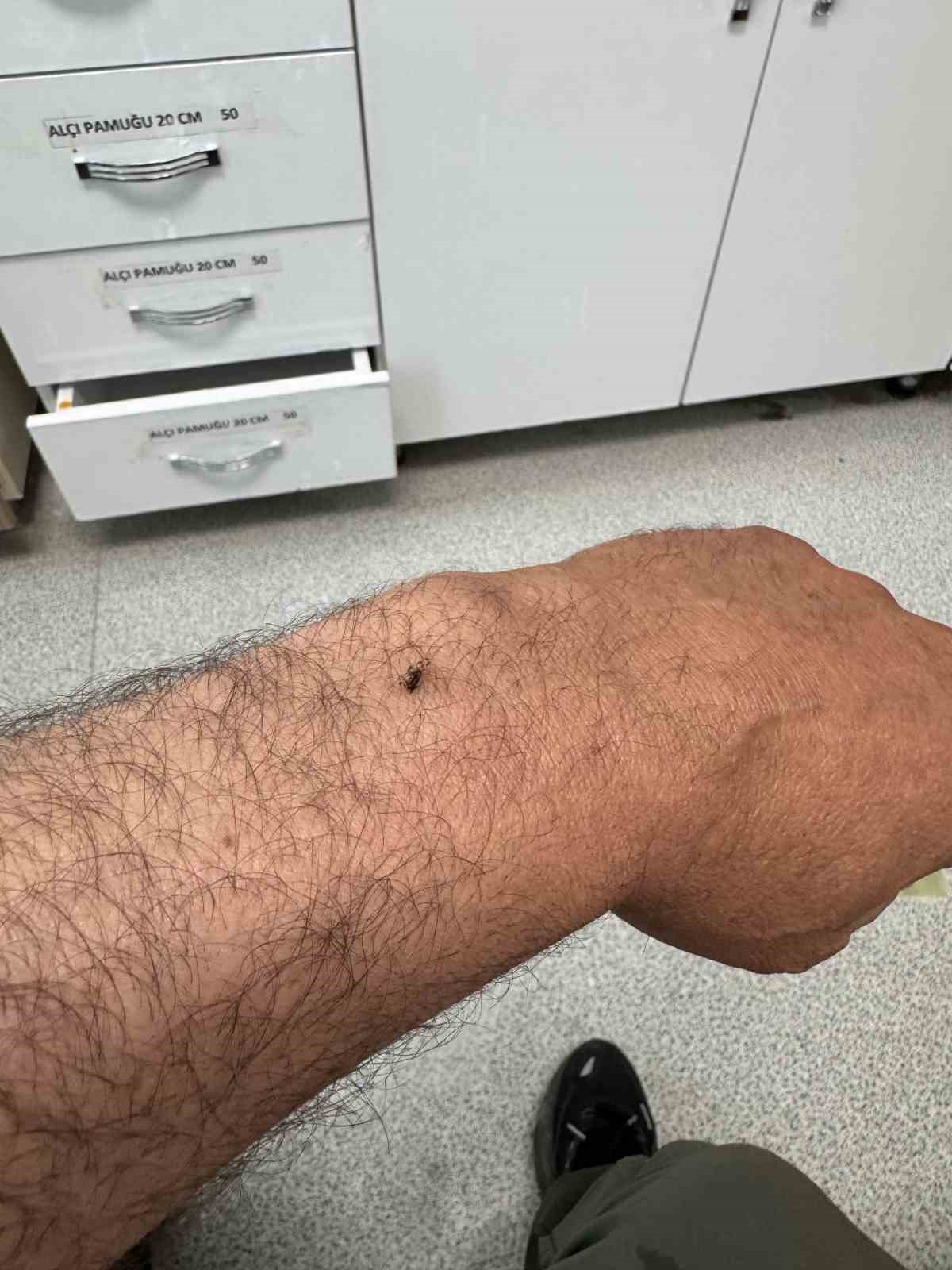 İtfaiye erinin koluna yapışan kene hastanede çıkarıldı 13 itfaiye erinin koluna yapisan kene hastanede cikarildi 9 ruuXERXl