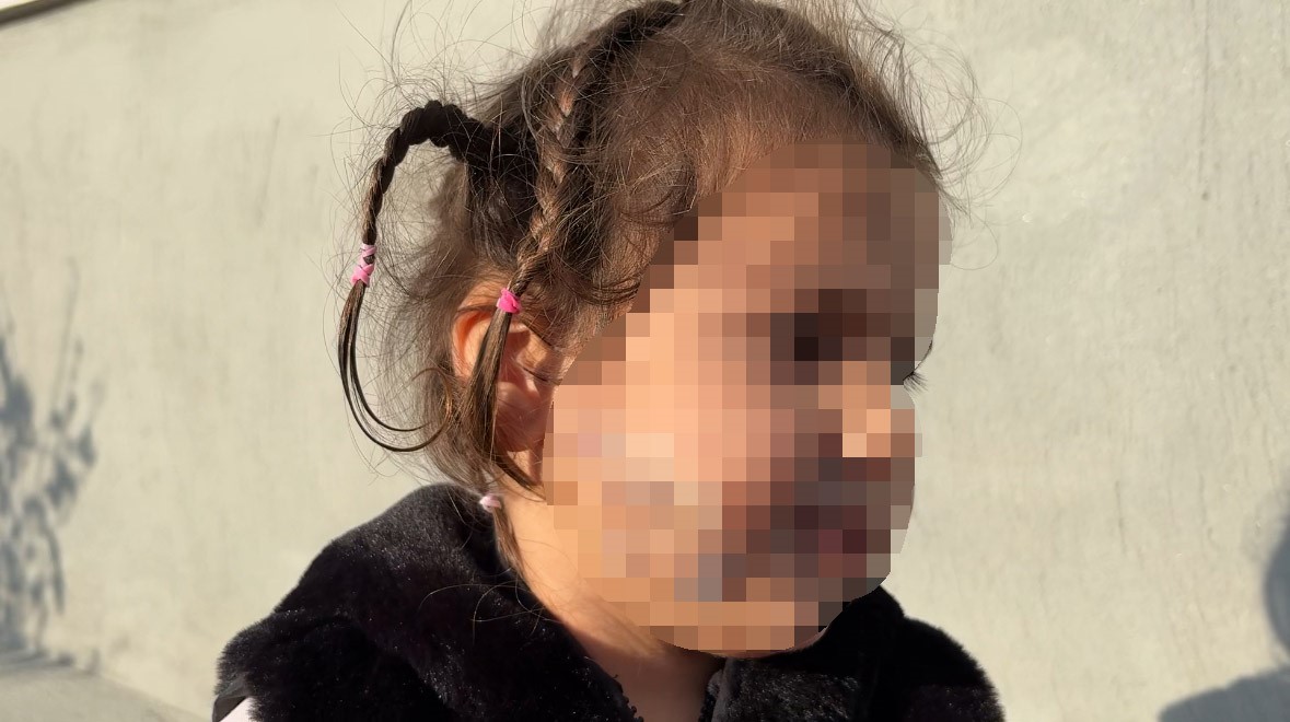 izmirde kopek dehseti 3 yasindaki adanin yuzu pence ve isirikla dolu 5 nDLjsnf8
