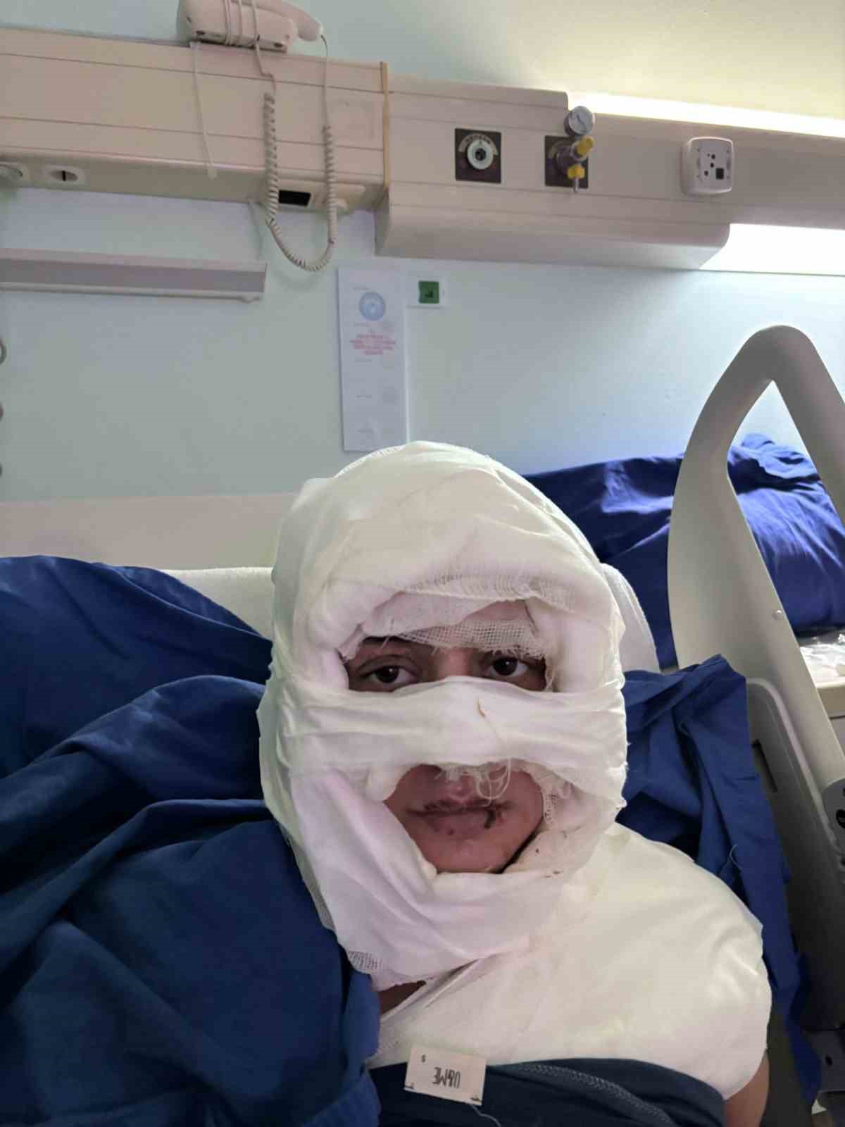 kadikoyde akil almaz olay genc kadin baska bir kadin tarafindan atese verildi 0 FrVtj5G4
