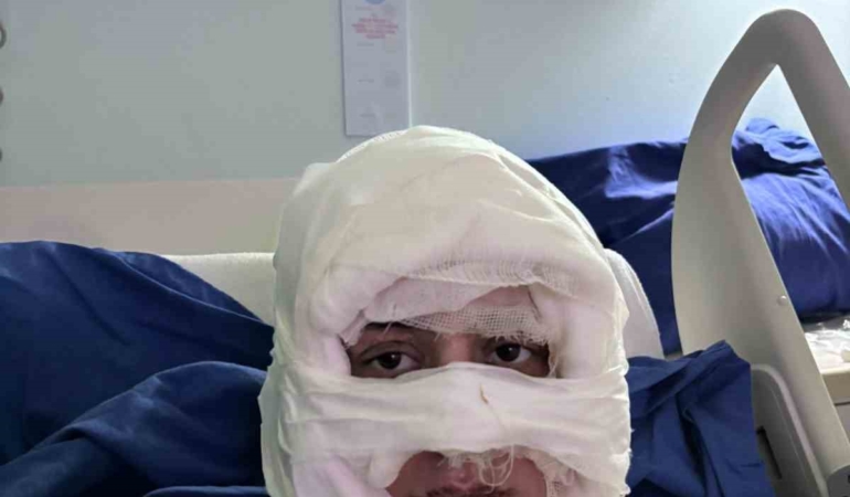 kadikoyde-akil-almaz-olay-genc-kadin-baska-bir-kadin-tarafindan-atese-verildi-57vZwX5F.jpg