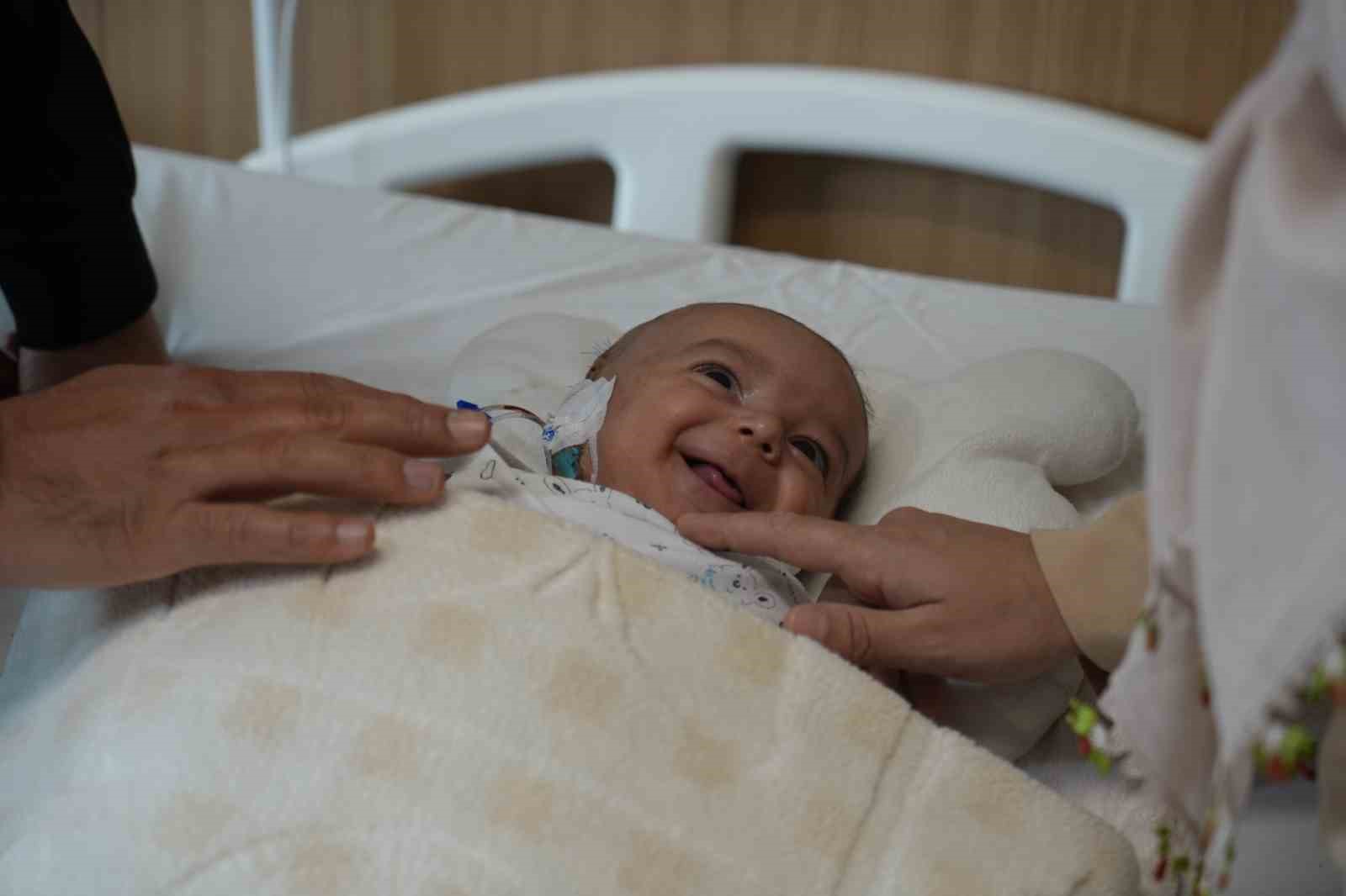 kafasindaki nadir tumor alindi hayata tekrar gulumsedi 2 XuX9Qc7C