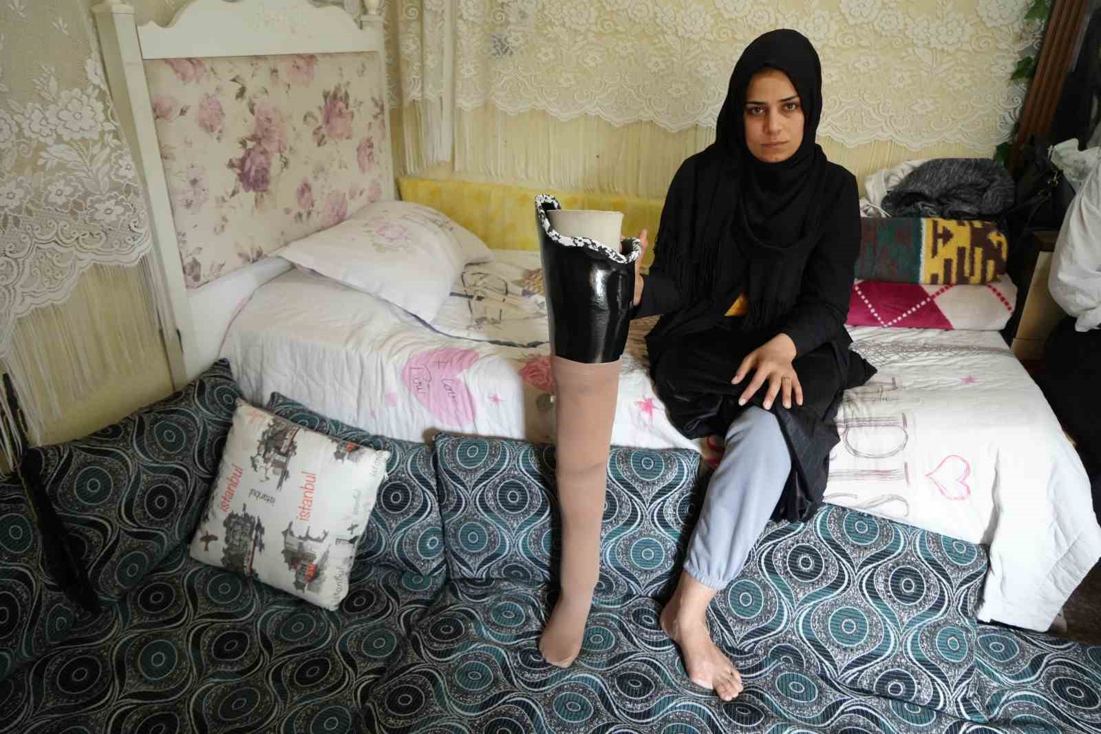 kahramanmaras merkezli buyuk depremde bacagini kaybetti esi terk etti 0 jAgVI7mk