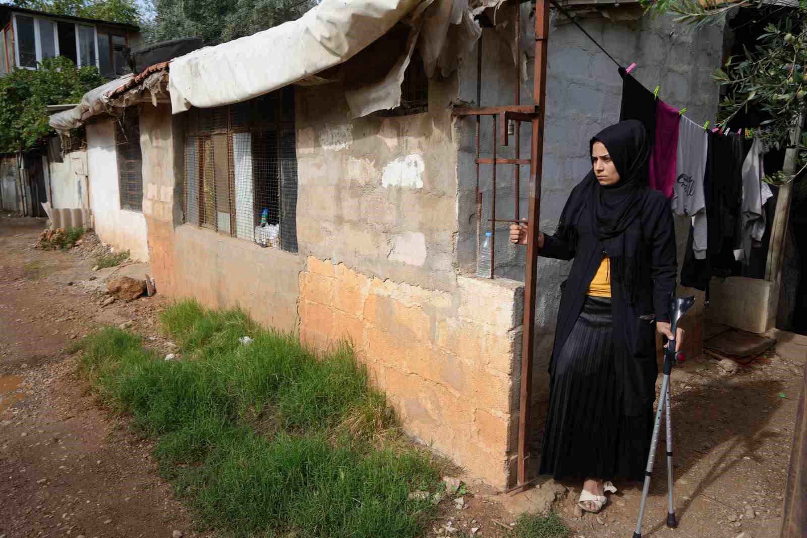 kahramanmaras merkezli buyuk depremde bacagini kaybetti esi terk etti 9 1l7MmAmJ