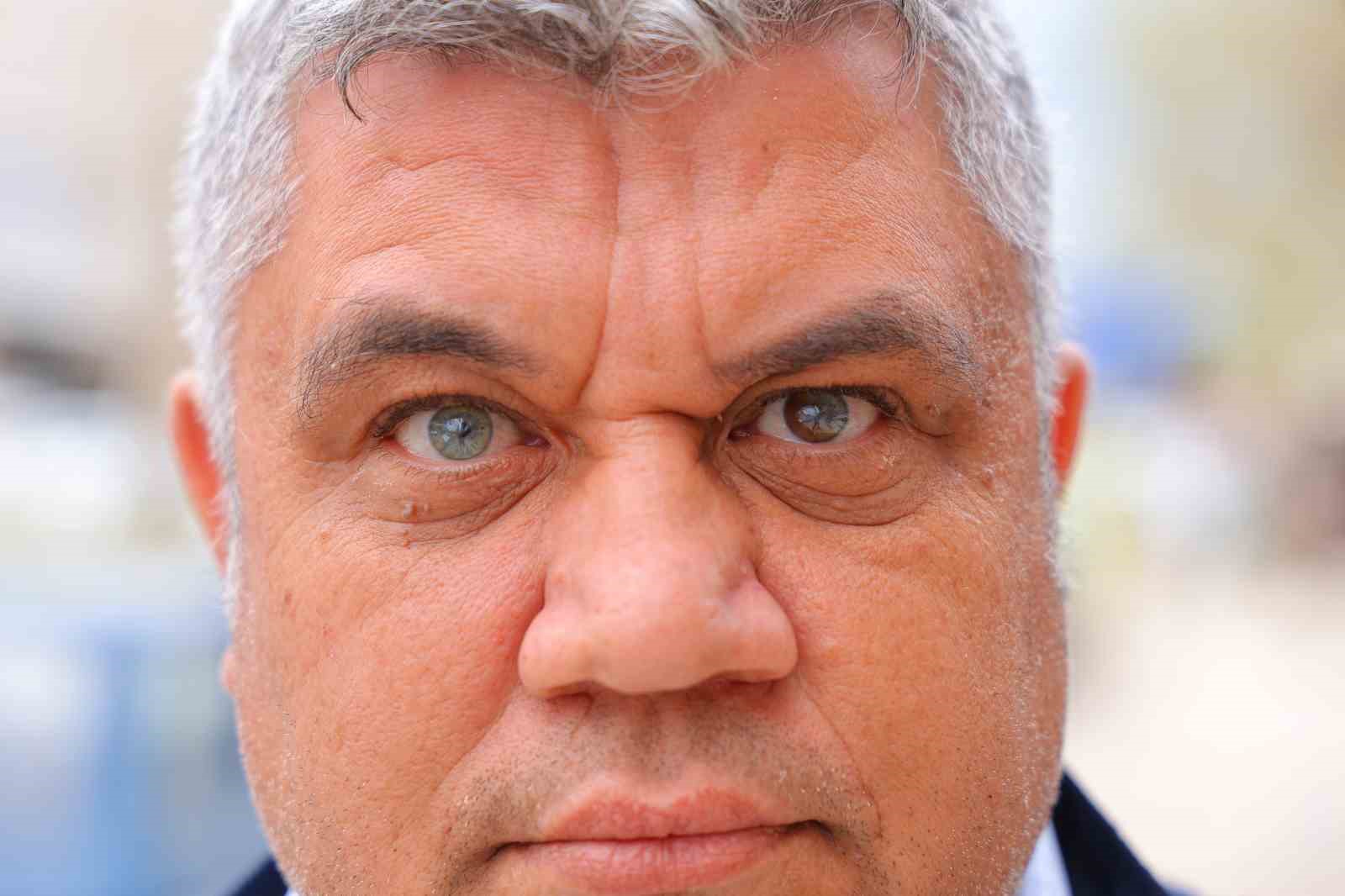 kahramanmarasli adam 3 renkli gozleriyle gorenlerin ilgisini cekiyor 0 kJ9mvEUk