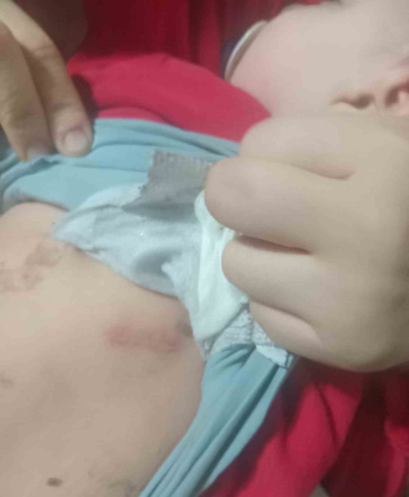 kahramanmarasta belinden zimba teli cikan bebegin ailesi sorumlularin ceza almasini istedi 5 Hy5hCwvh