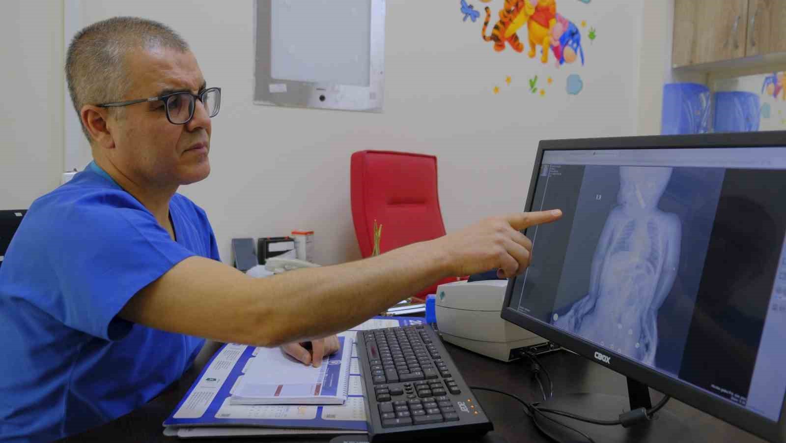 karamanda bogazina kumanda pili kacan bebek olumden dondu 0