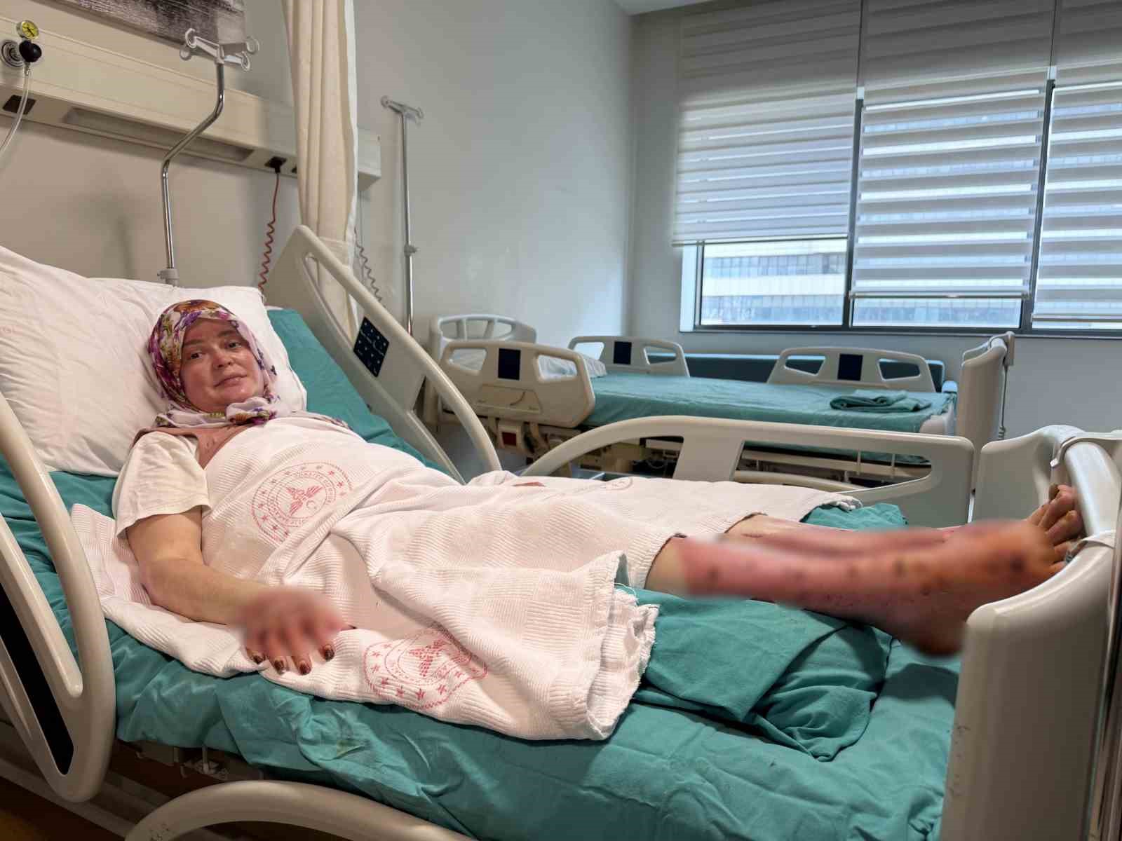karavandaki patlama sonrasi vucudunun yuzde 70i yandi karadeniz turu yapacaktik alev topuna dondum 0 MjVVf5Ew