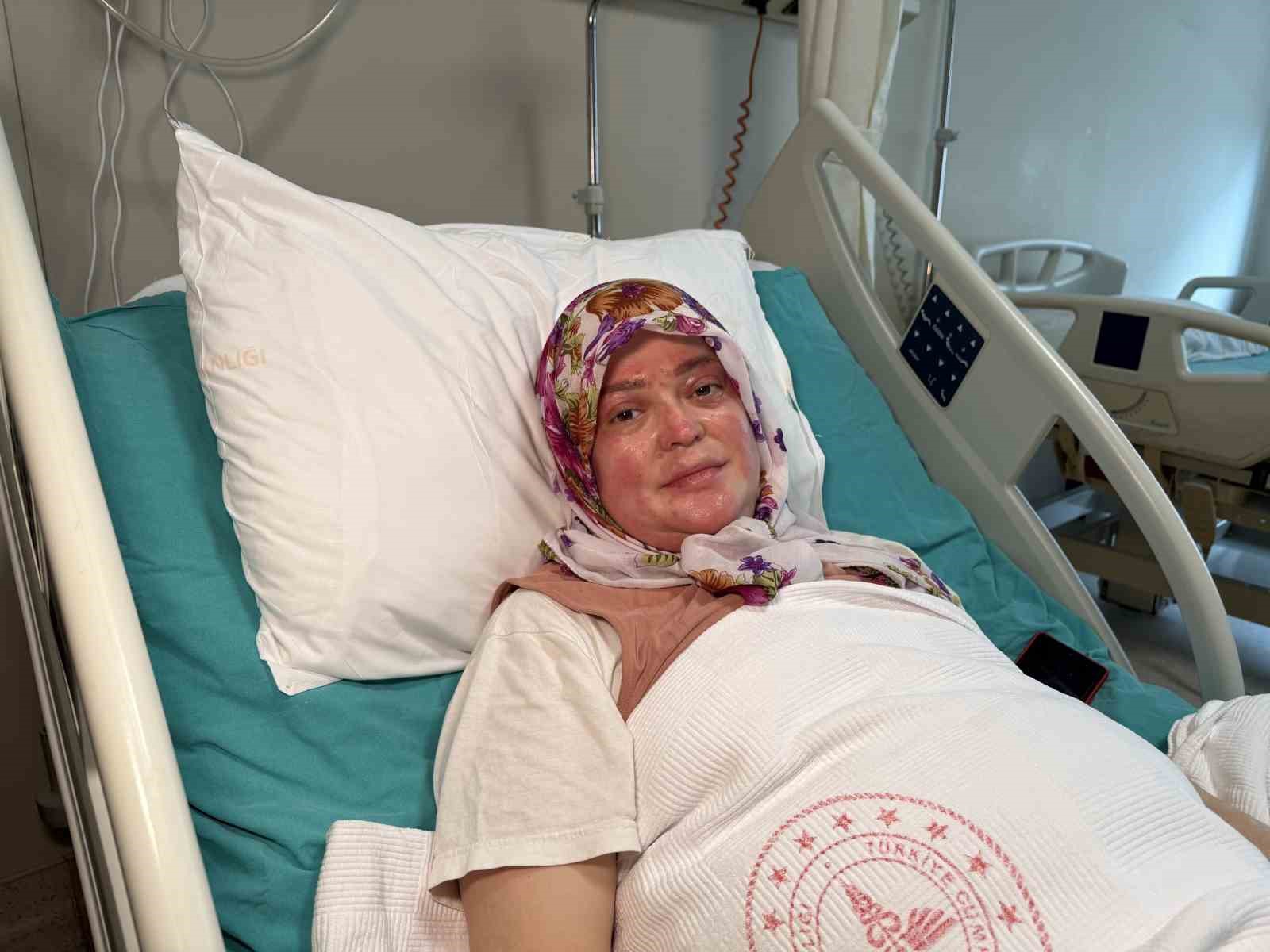 karavandaki patlama sonrasi vucudunun yuzde 70i yandi karadeniz turu yapacaktik alev topuna dondum 1 91QfF8Em