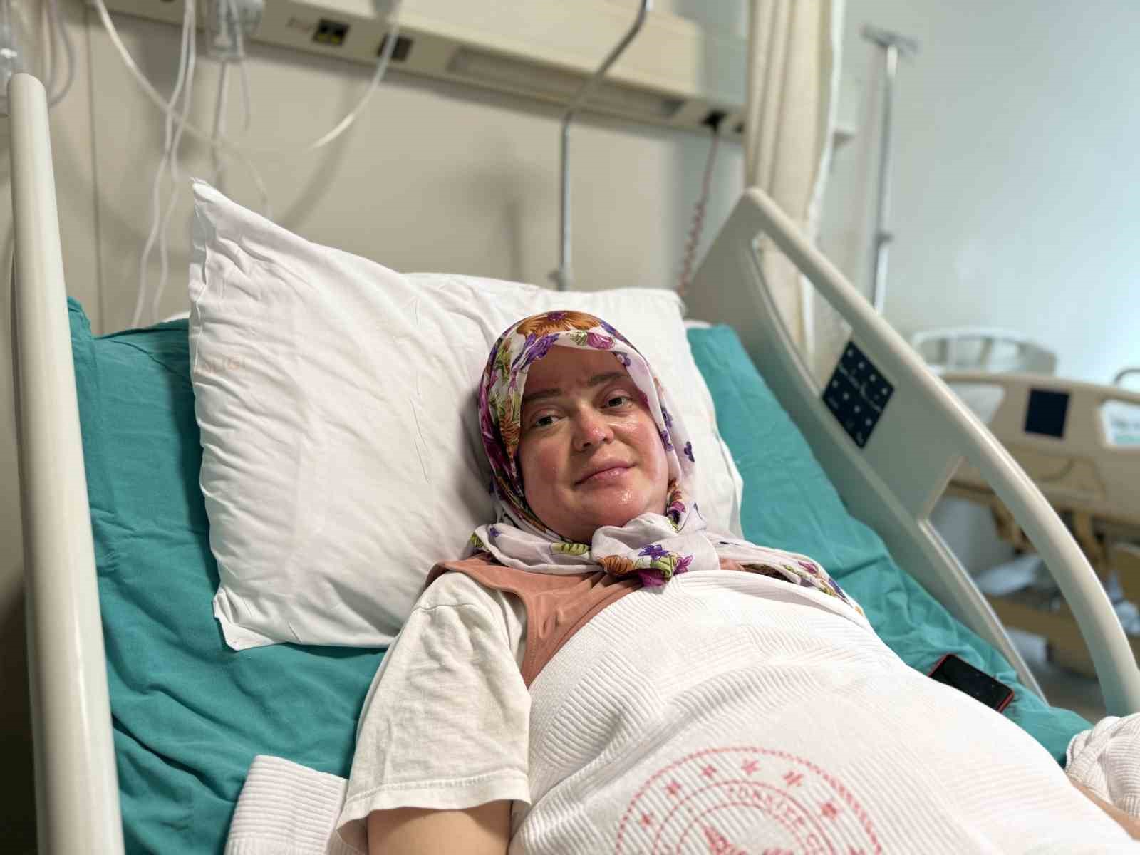 karavandaki patlama sonrasi vucudunun yuzde 70i yandi karadeniz turu yapacaktik alev topuna dondum 2 lj3R1aCN