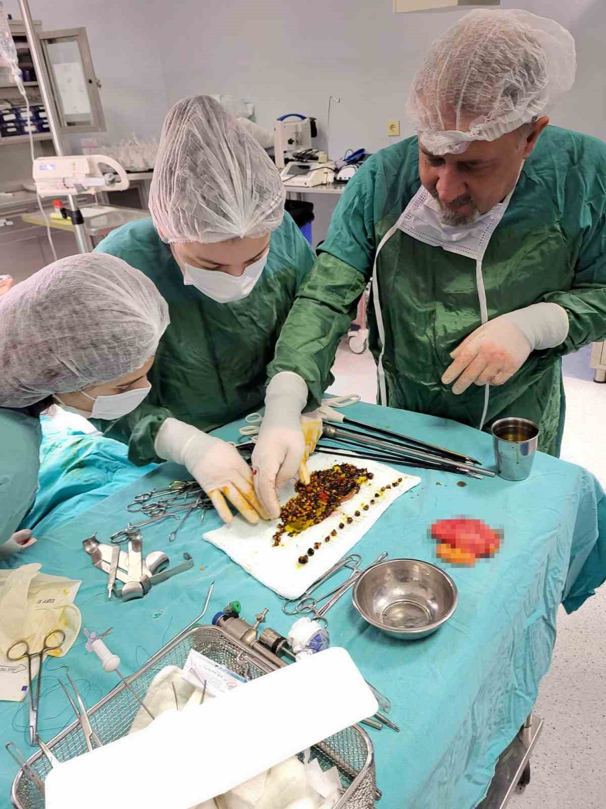 karin agrisiyla gitti safrasindan binlerce tas cikti 3 GzMvwYBV