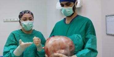 karni-2-ayda-9-aylik-hamile-gibi-buyuyen-kadinin-icinden-karpuz-kadar-kitle-cikarildi-ZQv1qSEr.jpg