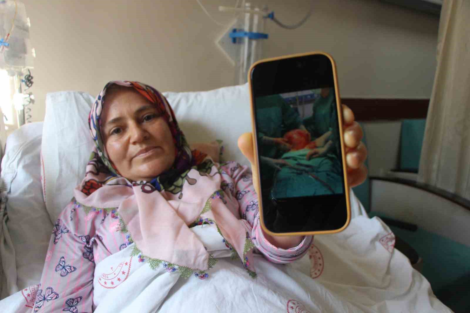 karni 2 ayda 9 aylik hamile gibi buyuyen kadinin icinden karpuz kadar kitle cikarildi uJh5vmw7