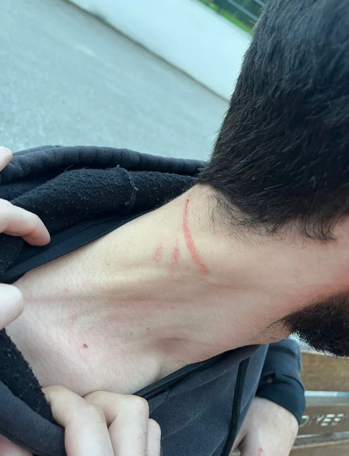Kartepe’deki kavganın en büyük mağduru çocuklar oldu: "Babama 5 kişi saldırdılar, kafasını ATV’ye vurdular" 10 kartepedeki kavganin en buyuk magduru cocuklar oldu babama 5 kisi saldirdilar kafasini atvye vurdular QIMl23vW