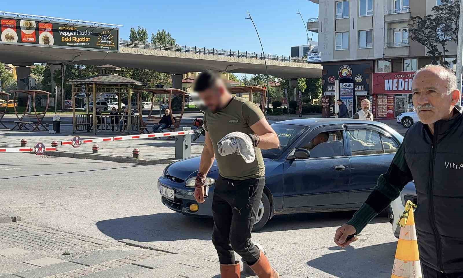 kayseride acemi kasaplar hastaneye kostu 1 Wv8DN7UQ