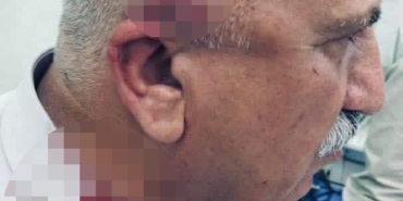 kerkukte-kacak-yapi-yikimi-sirasinda-kaymakama-bicakli-ve-sopali-saldiri-2NKtC3iw.jpg