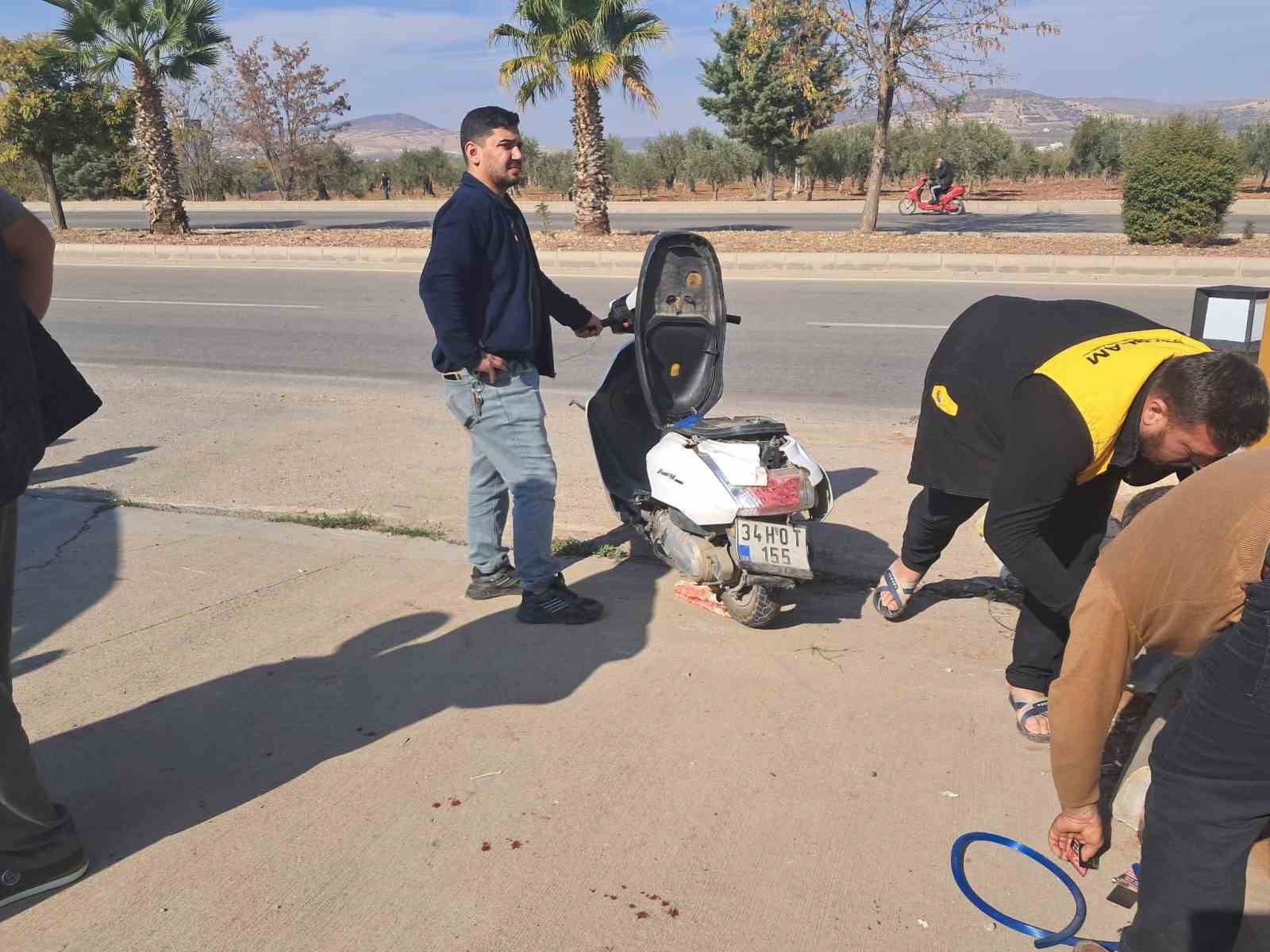 kiliste cip ile motosiklet carpisti 1 agir yarali 1 pp29kbg6