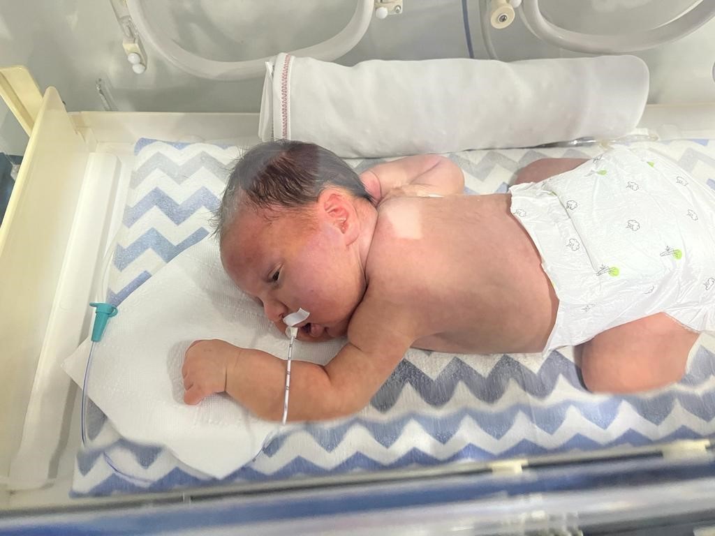 Kızı için su borularından yürüme bariyeri yaptı: "Baba ben de koşacağım" 13 kizi icin su borularindan yurume bariyeri yapti baba ben de kosacagim 9 KvMWaJT5