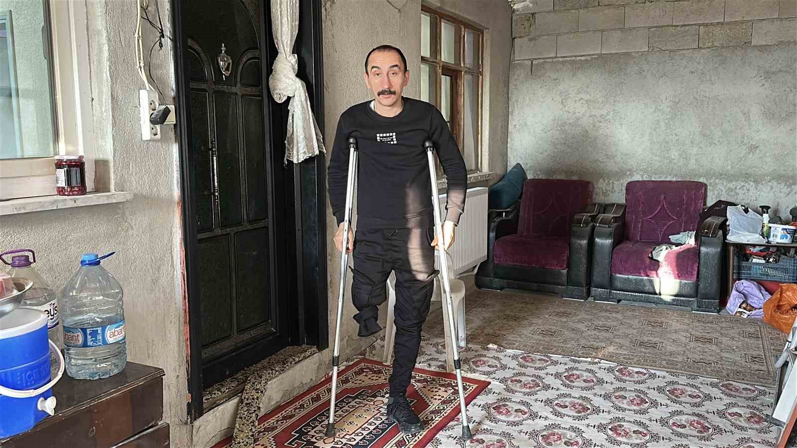 kizi icin yeniden ayaga kalkti protez bacagina kavustu 3 h2qTILPl