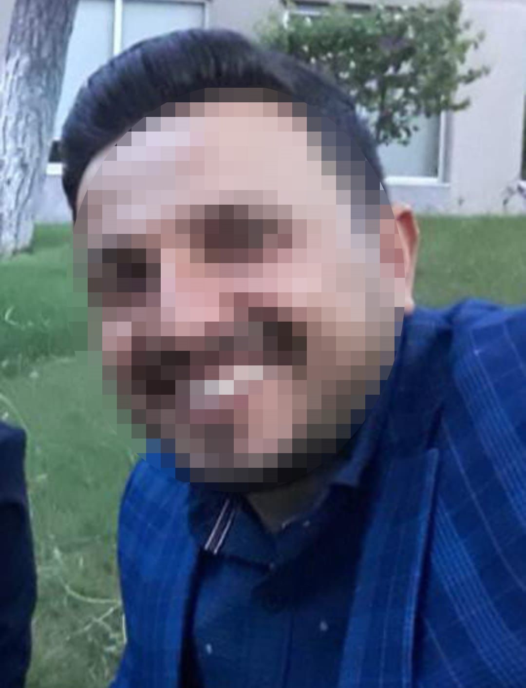 kocasinin olduresiye darp ettigi kadin dehset anlarini anlatti yoldan gecen vatandas olmasaydi olmustum 3 15m3MDAY