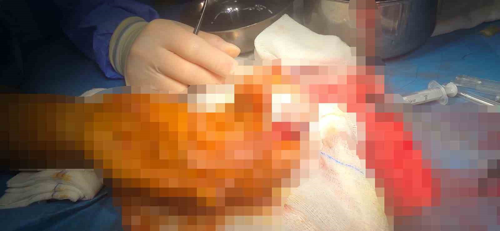 kopan parmagini buz posetine koyup yurt disindan turkiyeye geldi 2 Kb12aUYM