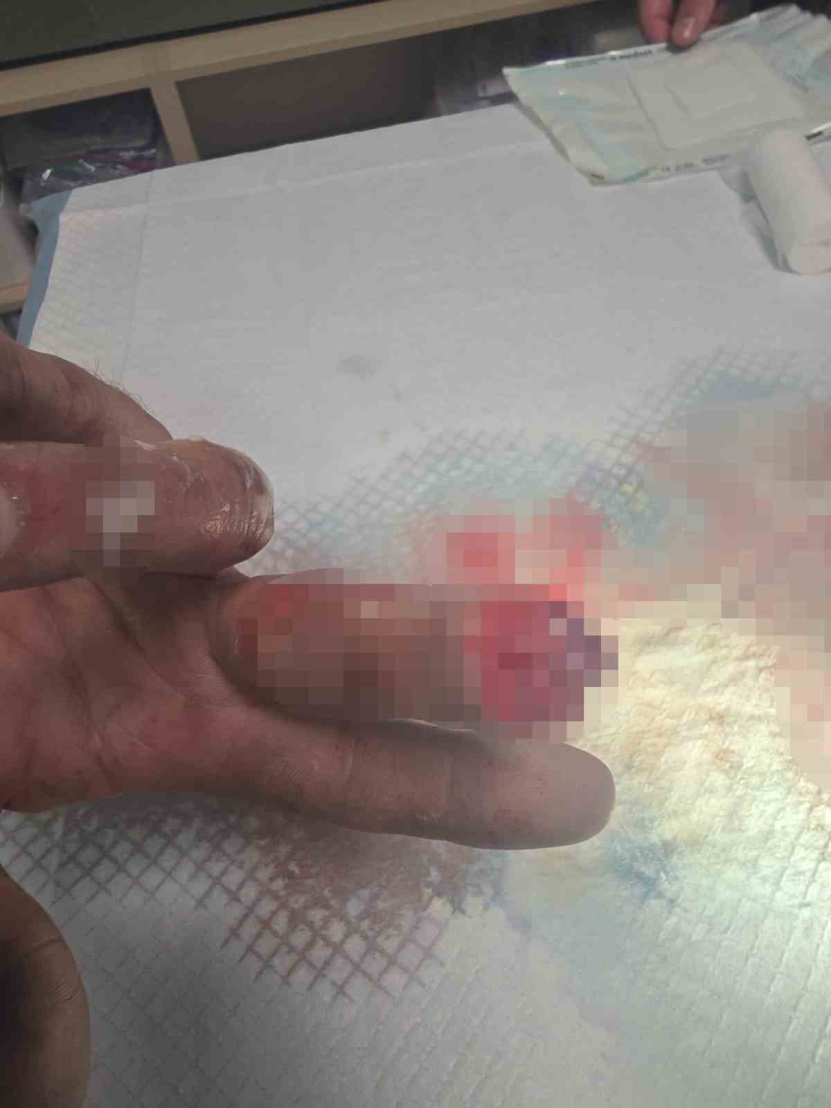 kopan parmagini buz posetine koyup yurt disindan turkiyeye geldi 3 qKEWPWeL