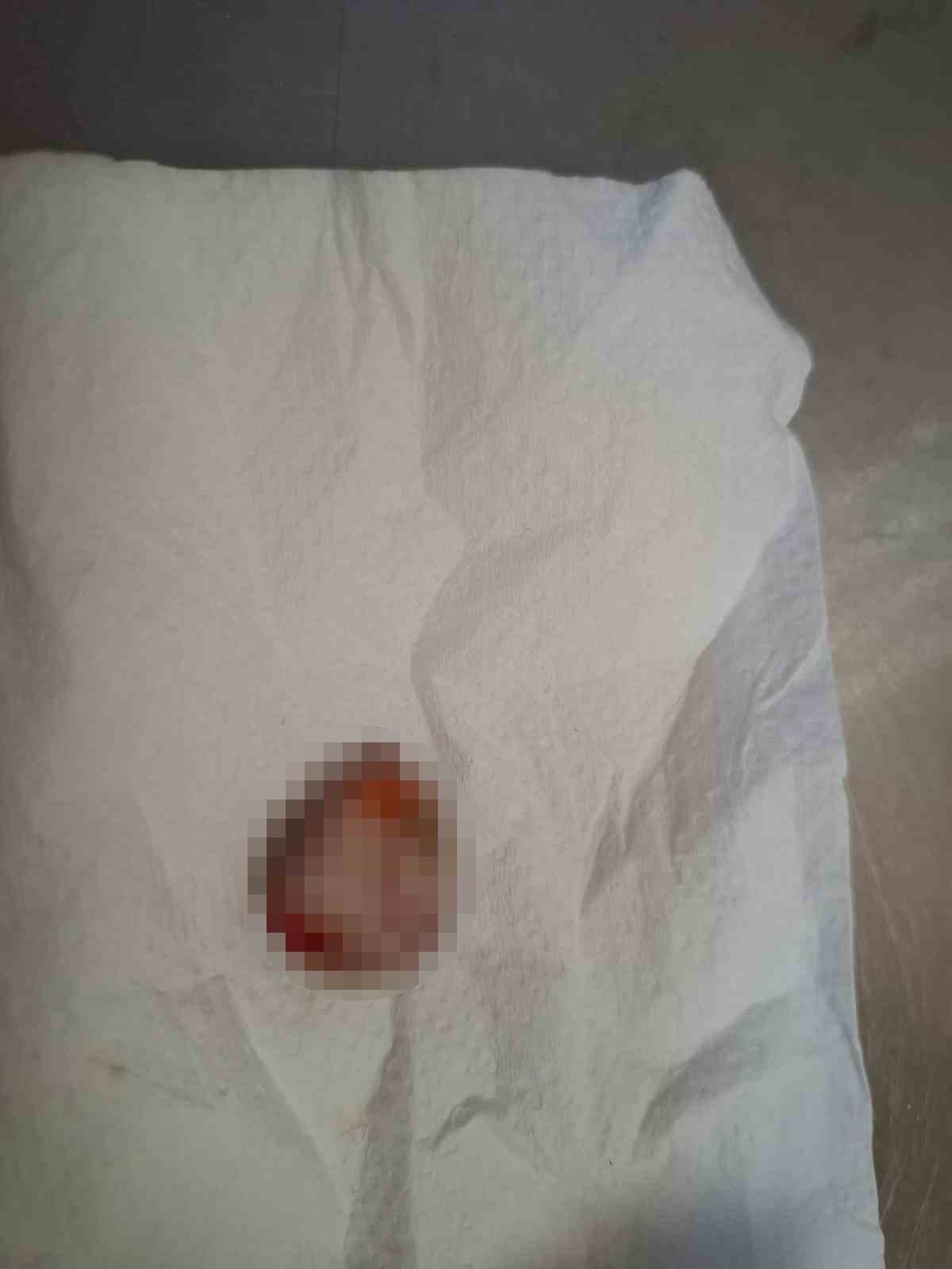 kopan parmagini buz posetine koyup yurt disindan turkiyeye geldi 4 jgUghzKW