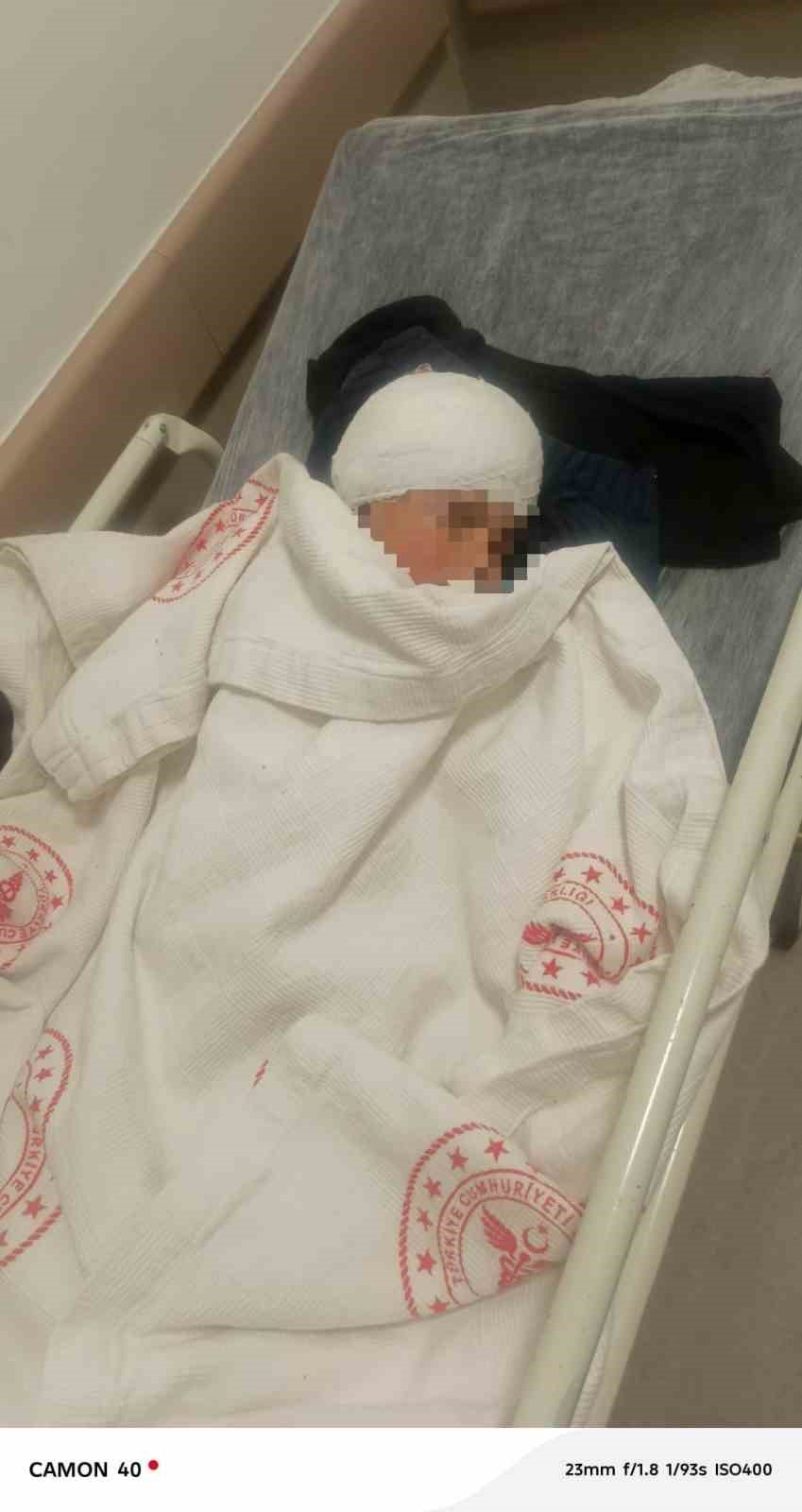 Köpek saldırısında yaralanan 3 yaşındaki bebek 34 gün sonra evine kavuştu 8 kopek saldirisinda yaralanan 3 yasindaki bebek 34 gun sonra evine kavustu 4 FSABYgcq