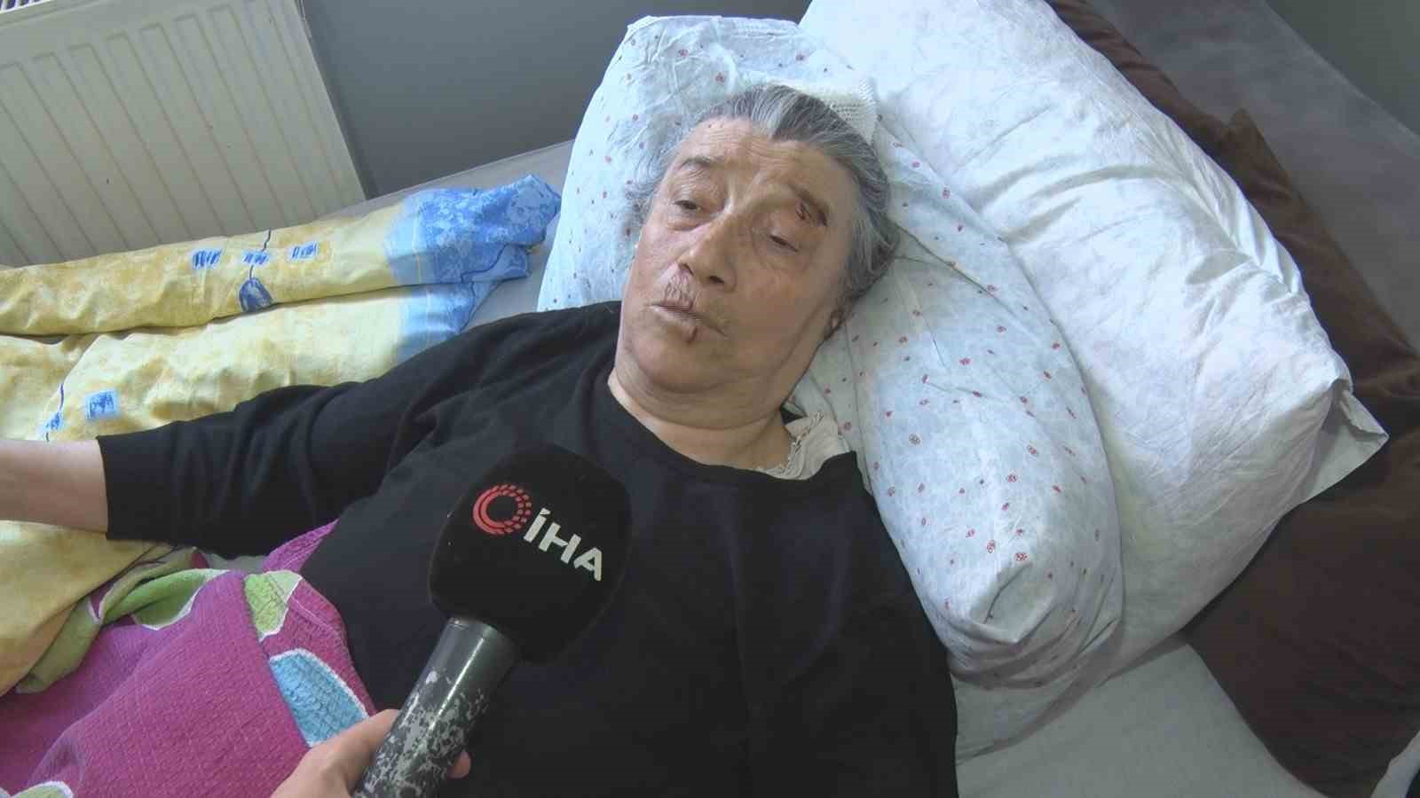 kopek surusunun saldirisinda agir yaralanan yasli kadin kolumu elimi basimi ve bacagimi parcaladilar 1 63JiVTGj