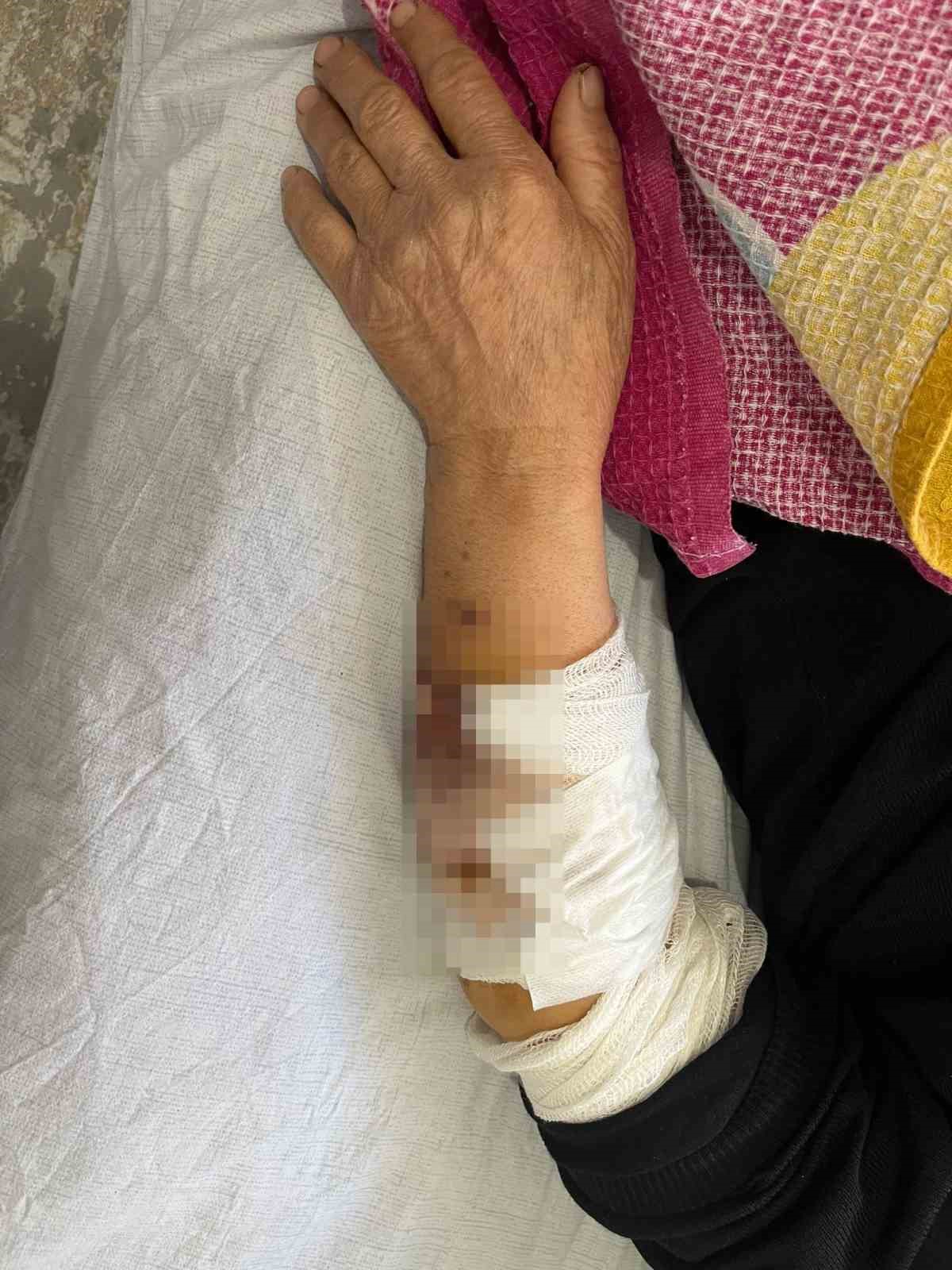 kopek surusunun saldirisinda agir yaralanan yasli kadin kolumu elimi basimi ve bacagimi parcaladilar 2 hsgv9WRw
